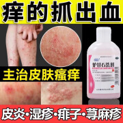 炉甘石洗剂100ml成人止痒湿疹皮肤病用药过敏止瘙痒热痱子蚊虫叮咬皮炎湿疹痱子瘙痒急性瘙痒性皮肤病 3盒【痒的抓破皮】疗程装