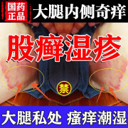 股癣用药膏 大腿根内测潮湿瘙痒大腿两侧长皮癣发红潮湿闷热出汗瘙痒红疹糜烂有异味腿裆有癣 克霉唑软膏 1盒【大腿内侧痒】