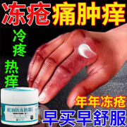 两面针冻疮膏止痒冻伤膏冻疮膏成人治专根特用冻手膏冻伤药消肿止痒ly 1盒【冻手冻脚摸一摸】不推荐