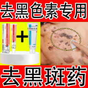 【黑色素沉淀去除药】尿素维E乳膏+熊果苷.乳霜 去黑斑去黑色素沉着修复沉淀脖子疤痕黑斑病专用药 尿素维E乳膏+熊果苷.乳霜【各1盒】新效期