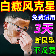 白癜风专用膏药进口促进黑色素生长脸手部白斑遮盖液补骨脂酊可搭 三盒装当晚见傚