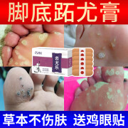 森卓止尤净去尤乐鸦胆子跖疣脚底趾疣瘊脚上非专用膏 1盒装