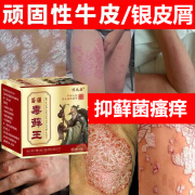 顽达康苗疆毒藓王抑藓菌乳膏男女大腿内侧疹红痒皮肤湿l疹外用抑菌膏 单盒装