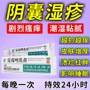 治疗男性阴囊湿疹阴囊瘙痒私处止痒药膏男性阴部裆部潮湿潮热会阴部大腿内侧痒红肿 克霉唑乳膏 1盒10g【克霉唑乳膏】