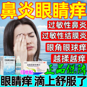 过敏性结膜炎眼药水鼻炎眼睛痒 鼻炎引起眼睛痒眼角里面痒干涩发痒眼痒消炎杀菌止痒眼药水 珍珠明目滴眼液 1盒【眼角干痒 眼球痒】