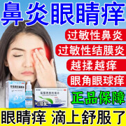 过敏性结膜炎鼻炎眼睛痒滴眼液 鼻炎引起眼睛痒眼角里面痒干涩发痒眼痒眼药水 珍珠明目滴眼液 本品+盐酸西替利嗪片【过敏性鼻炎眼睛痒】内服外用