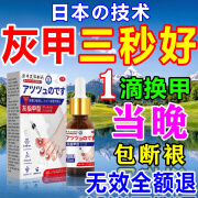 岩井昃弘灰指甲专用特傚效根i治进口正品冰醋酸溶液真菌感染增厚抑菌液药 1盒装