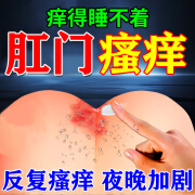 肛门瘙痒药膏 肛门湿疹去大腿根肛周湿疹瘙痒 肛门潮湿私处瘙痒专用特痒效止痒药膏 复方醋酸地塞米松乳膏 2盒[肛门瘙痒]【1药有+1棉签]