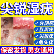 内廷上用尖锐湿疣男女性私处hpv病毒感染菜花丘i疹珠疹状肛周湿疣祛疣凝胶 三盒装  轻度推荐