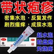 太平 阿昔洛韦乳膏可搭真菌感染皮肤用药止痒皮肤瘙痒嘴唇疱疹嘴角抗真菌带状疱疹生殖器疱疹水泡痱子 1盒