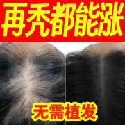 苗坚防脱育发洗发水快速固发密发护发防掉发男女通用 500g 一瓶强效装[激活深层毛囊]