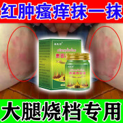 官方烧裆药大腿内侧防摩擦擦膏防烧裆大腿内侧防摩擦夏天神器走路大腿内侧根部出汗红 单盒体验装