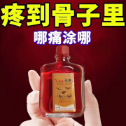 【五毒油】正品舒筋活络油跌打扭伤活血化瘀缓解腰椎关节疼痛消肿 25ml 一盒装【体验装】