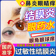 过敏性结膜炎鼻炎眼睛痒滴眼液鼻炎引起眼睛痒眼角里面痒干涩眼痒消炎杀菌眼药水 珍珠明目滴眼液 1盒装【眼角干痒】