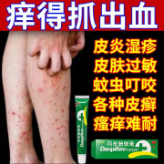 小腿痒腿上红疙瘩皮肤剧烈瘙痒止痒药膏软湿疹皮炎专用成人痒抗皮肤过敏消炎杀菌抑主图视觉特丹皮酚软膏 1盒装【小腿剧烈痒止痒】春季过敏