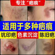 乔记本草疤痕增生凸起去除疙瘩祛疤痕修复除疤膏剖腹产专用膏修复 一盒装【建议周期使用】