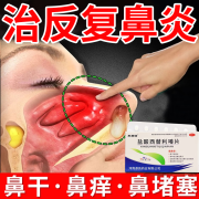 治鼻炎的药过敏性鼻炎【成人专用】鼻窦炎引起鼻塞打喷嚏流鼻涕盐酸西替利嗪片 一盒装【标准装】