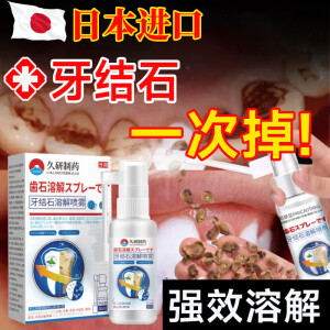 佑康力邦日本牙结石口腔冲洗器喷雾牙齿膏去味口臭去黄溶解去渍牙速效30ml 一盒牙结石猛掉【袪牙黄牙渍】