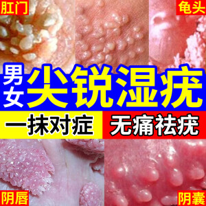 尖锐湿疣非药男性女性私处疣瘊肉粒丝状疣扁平疣专用怡美堂 1盒【单个疣体】 1盒【单个疣体】