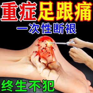 本草本草足跟痛专用药足底筋膜炎脚后跟腱骨刺疼痛肿胀去i根膏特傚效 三盒【买2送1】98%顾客选择