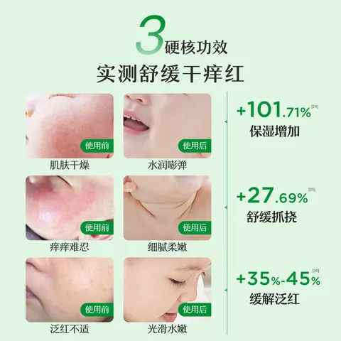 松达儿童面霜宝宝护肤保湿婴儿面霜润肤滋润山茶油霜68g 图片 6