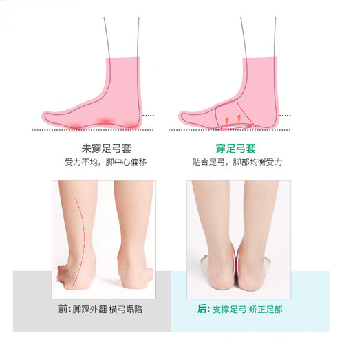 olera日本品牌扁平足矫正鞋垫足弓垫医用级儿童成人硅胶足弓塌陷支撑